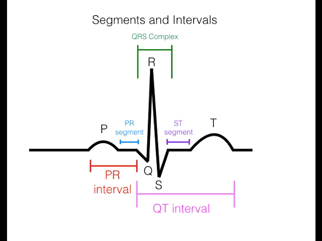 How to Read an EKG