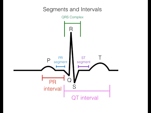 Understanding EKG Basics