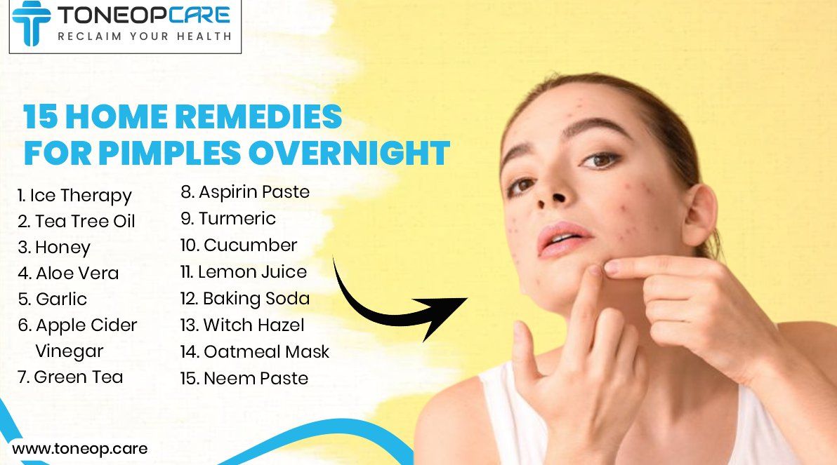 Natural remedies for pimples